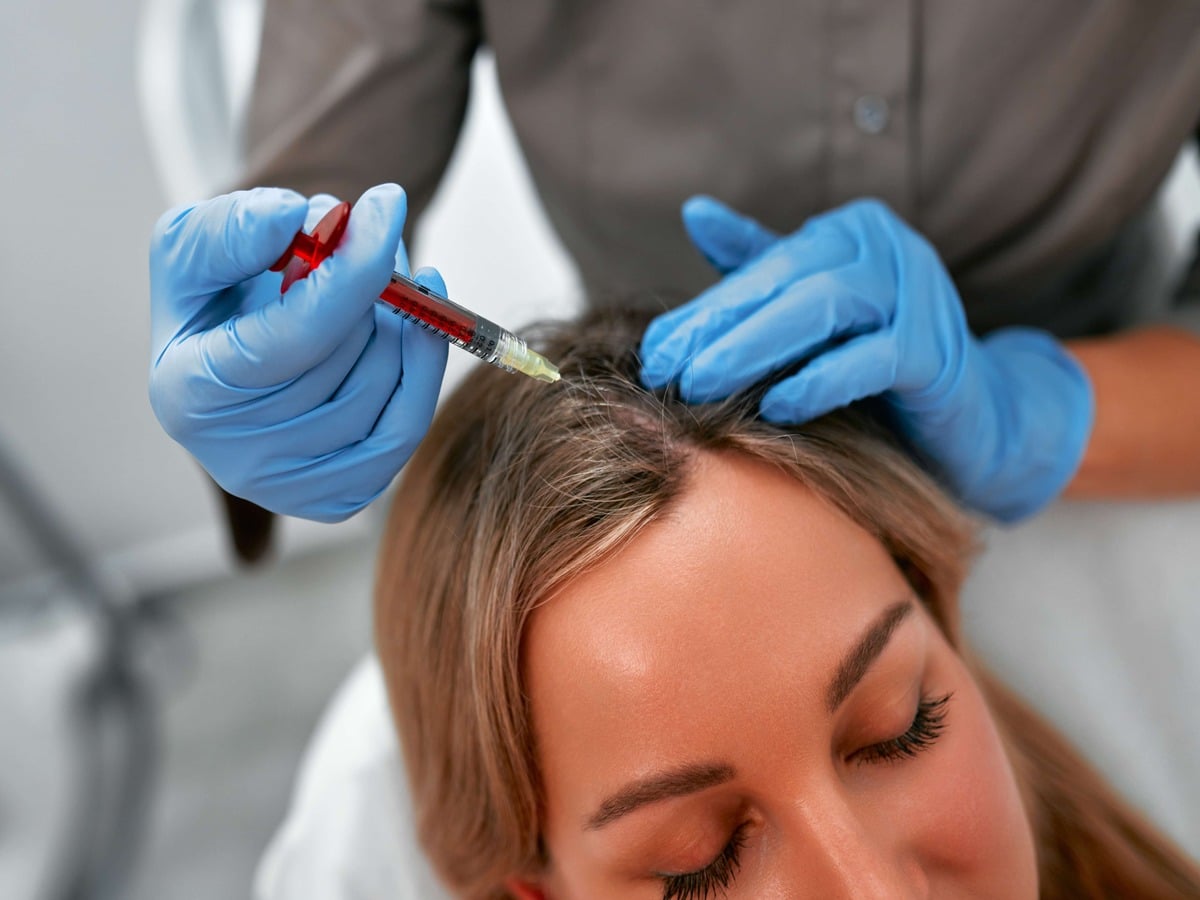 PRP for Hair Loss A by Skinlogicx in New York